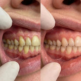 CollaGum™ product photo
